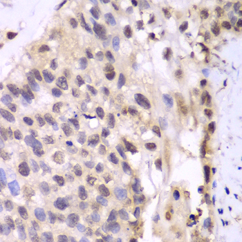 Anti-PSMA6 Antibody (CAB13536)