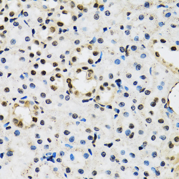 Anti-JADE1 Antibody (CAB12579)