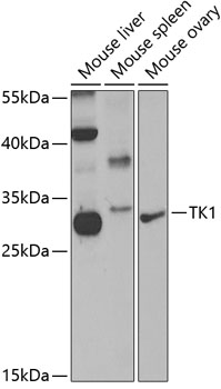 Anti-TK1 Antibody (CAB5612)