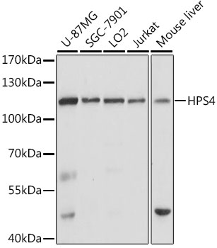 Anti-HPS4 Antibody (CAB16157)