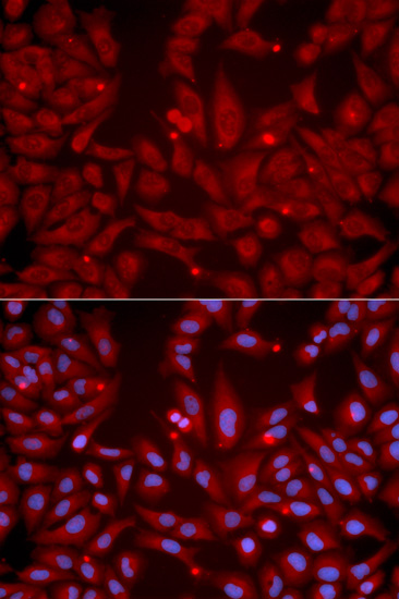 Anti-GRIK2 Antibody (CAB1939)