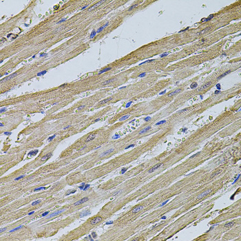 Anti-EIF4A2 Antibody (CAB3849)