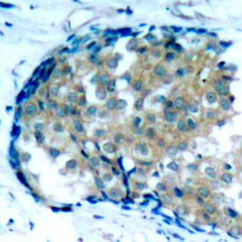 Anti-Phospho-Ezrin-Y353 Antibody (CABP0349)