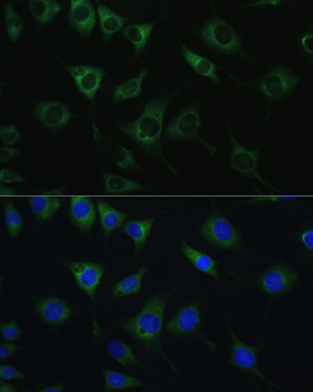 Anti-SRPRB Antibody (CAB10591)