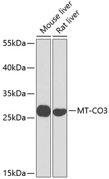 Anti-MT-CO3 Polyclonal Antibody (CAB9939)