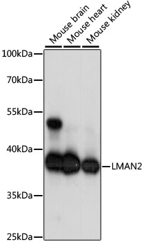 Anti-LMAN2 Antibody (CAB15394)