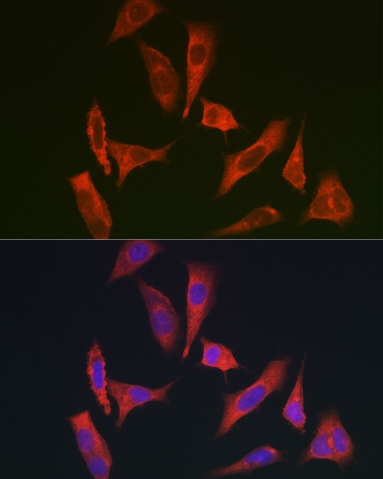 Anti-MYO10 Antibody (CAB12471)