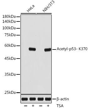 Anti-Acetyl-p53- K370 Antibody (CAB19836)