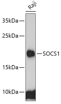 Anti-SOCS1 Antibody (CAB7754)