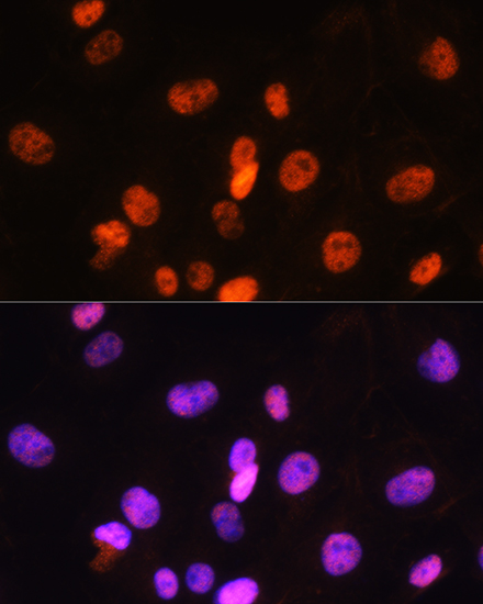 Anti-FANCD2 Antibody (CAB2072)