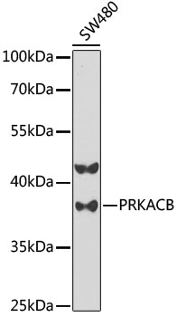 Anti-PRKACB Antibody (CAB5324)