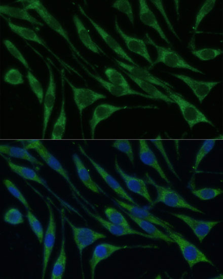 Anti-VARS Antibody (CAB4182)