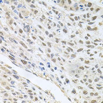 Anti-CDK1 Antibody (CAB2861)