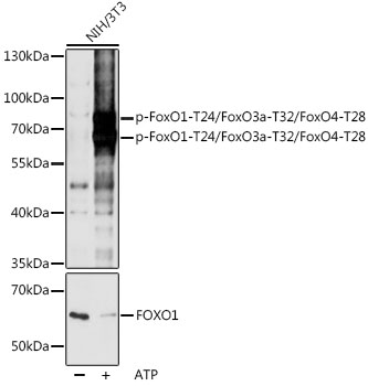 Anti-Phospho-FoxO1-T24/FoxO3a-T32/FoxO4-T28 pAb (CABP0892)