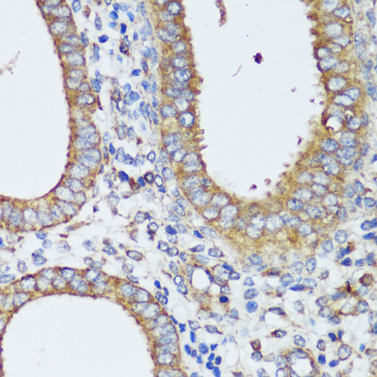 Anti-ERK1 / ERK2 Antibody (CAB16686)