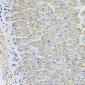 Anti-EFHC1 Polyclonal Antibody (CAB8002)