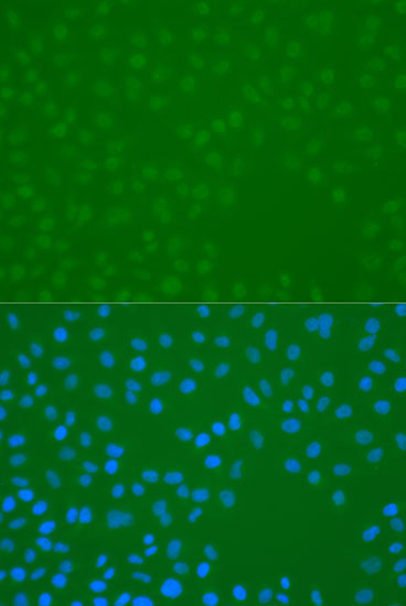 Anti-Phospho-CHEK1-S296 pAb (CABP0831)