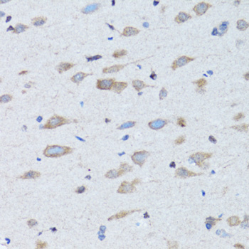 Anti-NDP Antibody (CAB12470)