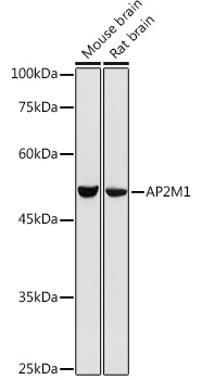 Anti-AP2M1 Antibody (CAB13962)