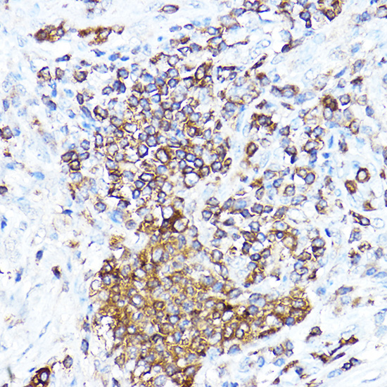 Anti-cIAP2 Antibody (CAB0833)