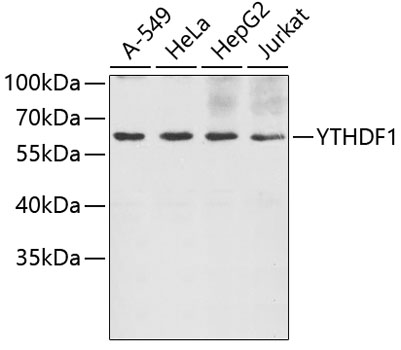 Anti-YTHDF1 Antibody (CAB5985)