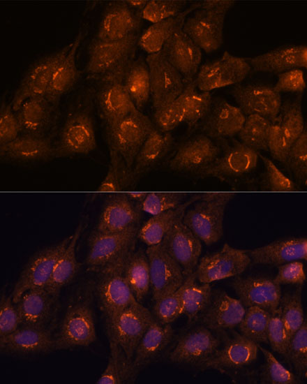 Anti-ACBD3 Antibody (CAB16568)