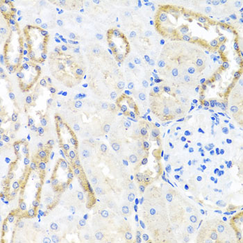 Anti-BSND Antibody (CAB7747)