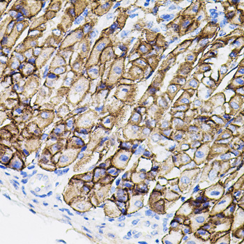 Anti-MMP9 Antibody (CAB11391)