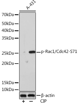 Anti-Phospho-Rac1/Cdc42-S71 Antibody (CABP1018)