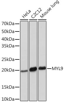 Anti-MYL9 Antibody (CAB8738)