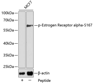 Anti-Phospho-Estrogen receptor-S167 Antibody (CABP0348)