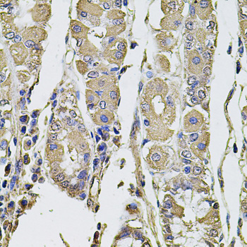 Anti-PTHLH Antibody (CAB12492)