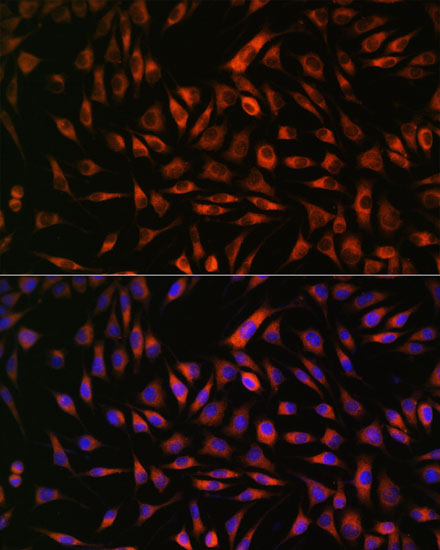 Anti-EML4 Antibody (CAB16117)