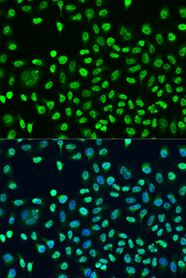 Anti-STAU2 Antibody (CAB3413)