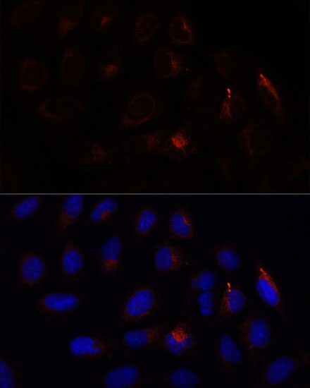 Anti-CHP1 Antibody (CAB15791)