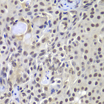 Anti-PRKDC Antibody (CAB7716)