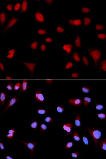 Anti-Phospho-ABL1-Y204 Antibody (CABP0003)