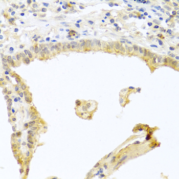 Anti-PRKCA Antibody (CAB0267)