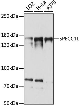 Anti-SPECC1L Antibody (CAB15798)