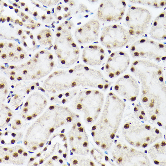 Anti-ACTL6A Antibody (CAB5387)