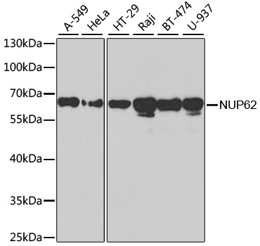 Anti-NUP62 Antibody (CAB2499)