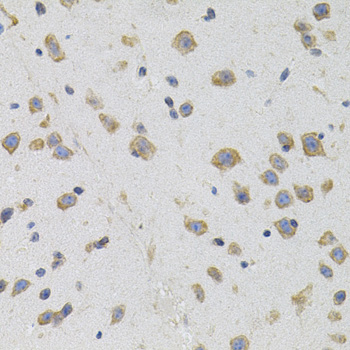 Anti-SIGMAR1 Antibody (CAB5479)