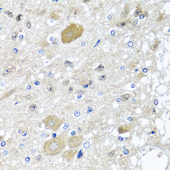 Anti-CST1 Antibody (CAB6570)