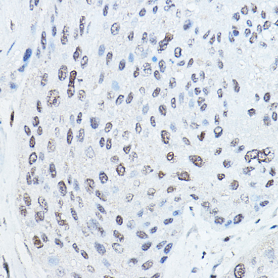 Anti-CEBPA Antibody (CAB0904)