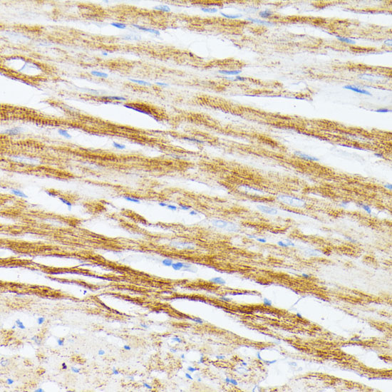 Anti-TPM2 Antibody (CAB3096)