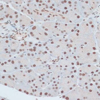 Anti-ZNF416 Antibody (CAB14910)