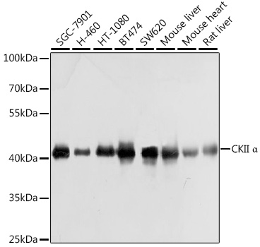 Anti-CKII Alpha Antibody (CAB1014)