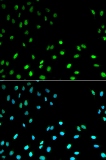 Anti-RFC1 Antibody (CAB1625)