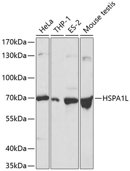 Anti-HSPA1L Antibody (CAB1856)