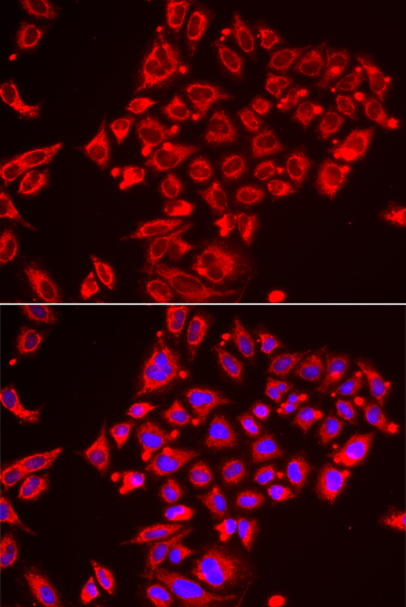 Anti-ST3GAL3 Antibody (CAB6753)